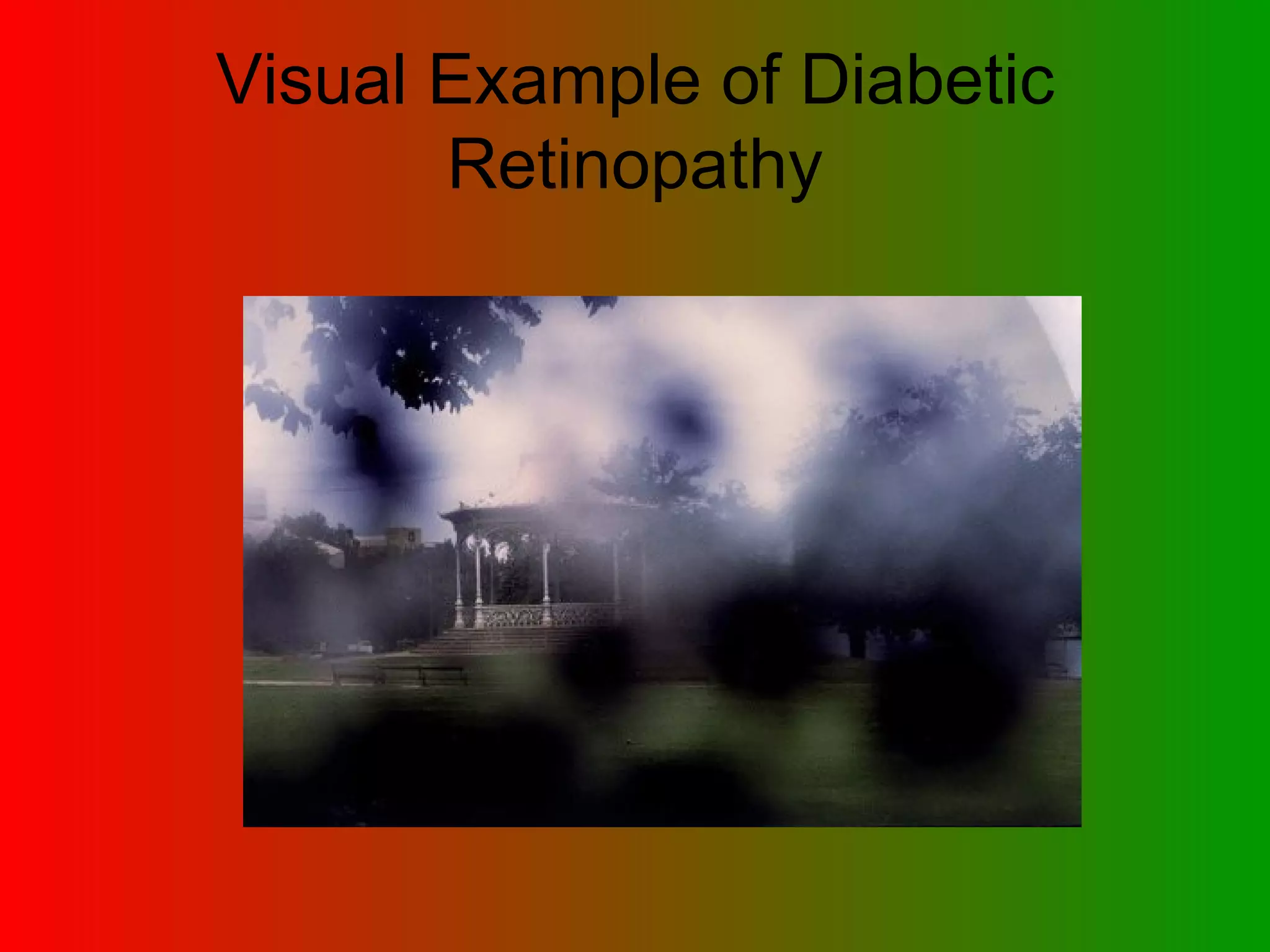 Visual Example of Diabetic Retinopathy 
