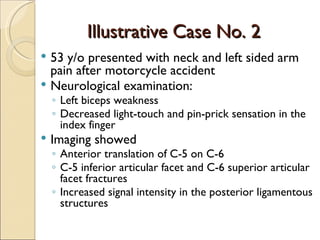 Illustrative Case No. 2 53 y/o presented with neck and left sided arm pain after motorcycle accident Neurological examination:  Left biceps weakness Decreased light-touch and pin-prick sensation in the index finger Imaging showed Anterior translation of C-5 on C-6 C-5 inferior articular facet and C-6 superior articular facet fractures Increased signal intensity in the posterior ligamentous structures 