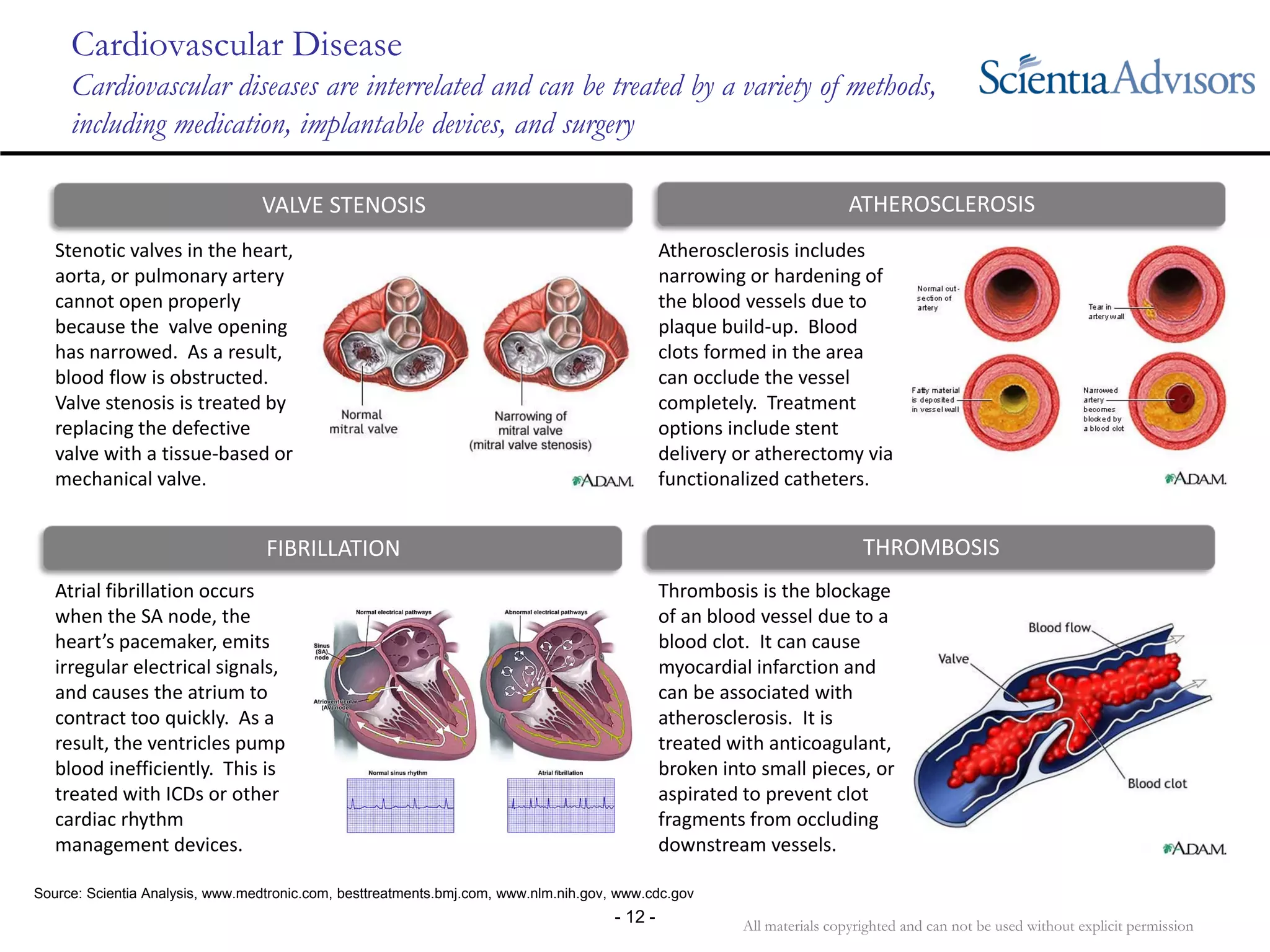 All materials copyrighted and can not be used without explicit permission
- 12 -
Cardiovascular Disease
Cardiovascular diseases are interrelated and can be treated by a variety of methods,
including medication, implantable devices, and surgery
Stenotic valves in the heart, 
aorta, or pulmonary artery 
cannot open properly 
because the  valve opening 
has narrowed.  As a result, 
blood flow is obstructed.  
Valve stenosis is treated by 
replacing the defective 
valve with a tissue‐based or 
mechanical valve.
Source: Scientia Analysis, www.medtronic.com, besttreatments.bmj.com, www.nlm.nih.gov, www.cdc.gov
Atherosclerosis includes 
narrowing or hardening of 
the blood vessels due to 
plaque build‐up.  Blood 
clots formed in the area 
can occlude the vessel 
completely.  Treatment 
options include stent 
delivery or atherectomy via 
functionalized catheters.
Atrial fibrillation occurs 
when the SA node, the 
heart’s pacemaker, emits 
irregular electrical signals, 
and causes the atrium to 
contract too quickly.  As a 
result, the ventricles pump 
blood inefficiently.  This is 
treated with ICDs or other 
cardiac rhythm 
management devices.
Thrombosis is the blockage 
of an blood vessel due to a 
blood clot.  It can cause 
myocardial infarction and 
can be associated with 
atherosclerosis.  It is 
treated with anticoagulant, 
broken into small pieces, or 
aspirated to prevent clot 
fragments from occluding 
downstream vessels.  
VALVE STENOSIS ATHEROSCLEROSIS
FIBRILLATION THROMBOSIS
 