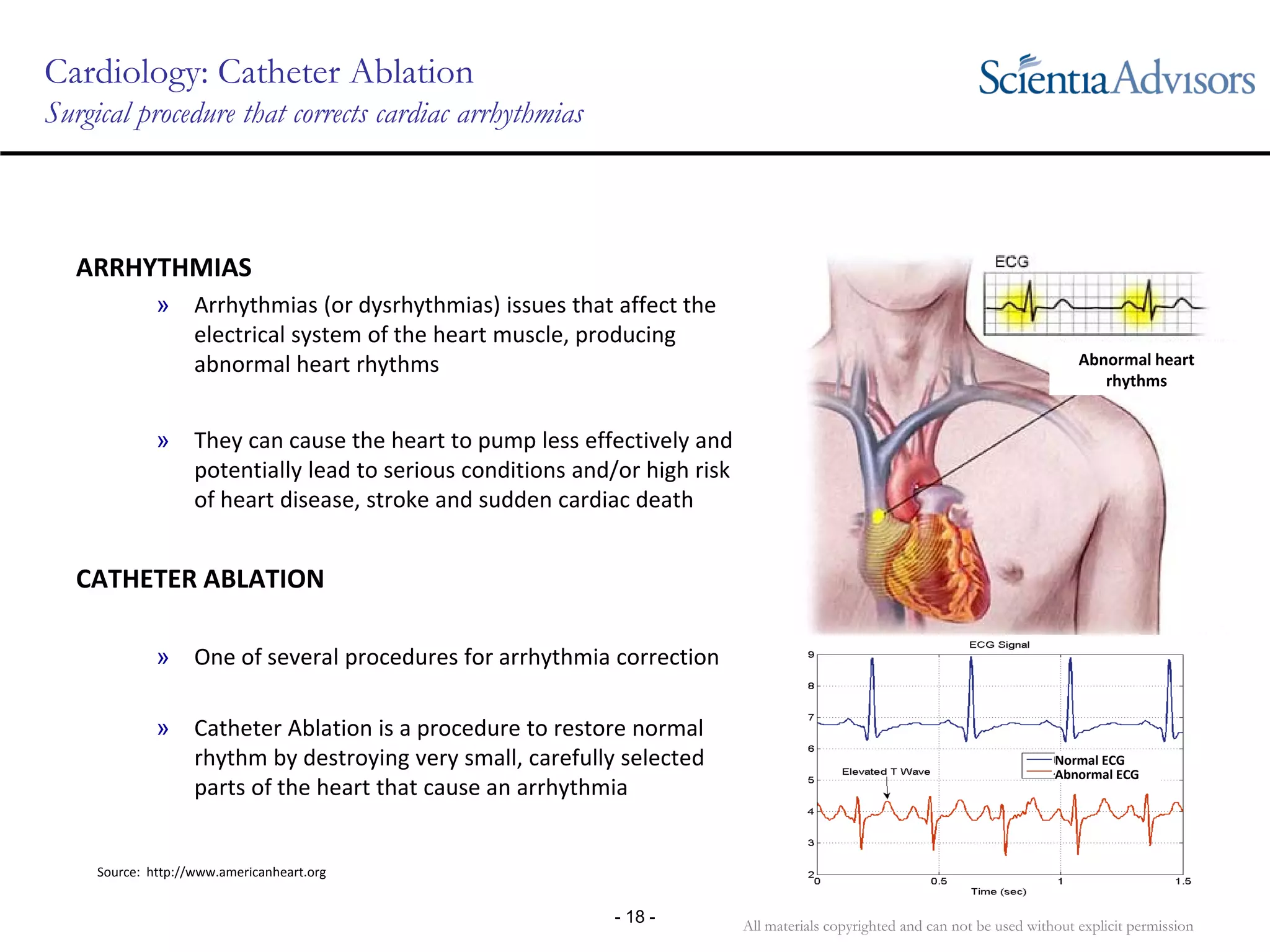 All materials copyrighted and can not be used without explicit permission
- 18 -
Cardiology: Catheter Ablation
Surgical procedure that corrects cardiac arrhythmias
ARRHYTHMIAS
» Arrhythmias (or dysrhythmias) issues that affect the 
electrical system of the heart muscle, producing 
abnormal heart rhythms
» They can cause the heart to pump less effectively and 
potentially lead to serious conditions and/or high risk 
of heart disease, stroke and sudden cardiac death
CATHETER ABLATION
» One of several procedures for arrhythmia correction
» Catheter Ablation is a procedure to restore normal 
rhythm by destroying very small, carefully selected 
parts of the heart that cause an arrhythmia
Source:  http://www.americanheart.org
Abnormal heart 
rhythms
Ablation Catheter
Normal ECG
Abnormal ECG
 
