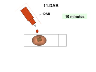 DAB 11.DAB 10 minutes 