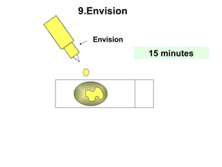 Envision 9.Envision 15 minutes 