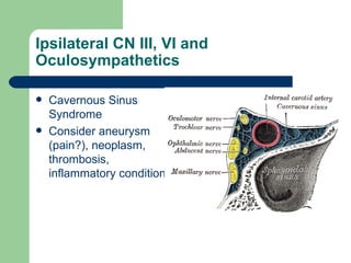 Ipsilateral CN III, VI and Oculosympathetics Cavernous Sinus Syndrome Consider aneurysm (pain?), neoplasm, thrombosis, inflammatory conditions 