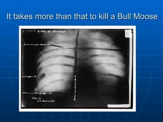 It takes more than that to kill a Bull Moose   