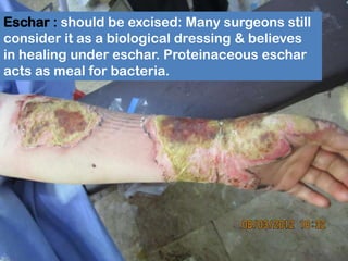 Wound Healing | PPTX