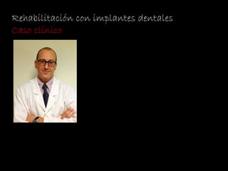 Rehabilitación con implantes dentales
Caso clínico
 