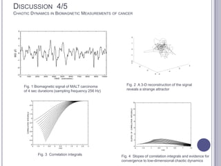 DISCUSSION 4/5
CHAOTIC DYNAMICS IN BIOMAGNETIC MEASUREMENTS OF CANCER
0 100 200 300 400 500 600 700 800 900 1000
-3
-2
-1
0
1
2
3
TIME (samples)
MGG(pT)
-4
-2
0
2
-4
-2
0
2
-2
-1
0
1
2
-2 -1.5 -1 -0.5 0 0.5 1 1.5 2 2.5 3
-5
-4.5
-4
-3.5
-3
-2.5
-2
-1.5
-1
-0.5
0
Ln(r)
CORRELATIONINTEGRALS
-2 -1.5 -1 -0.5 0 0.5 1 1.5
0
2
4
6
8
10
12
14
Ln(r)
SLOPESOFCORRELATIONINTEGRALS
Fig. 1 Biomagnetic signal of MALT carcinoma
of 4 sec durations (sampling frequency 256 Hz)
Fig. 2 A 3-D reconstruction of the signal
reveals a strange attractor
Fig. 3 Correlation integrals Fig. 4 Slopes of correlation integrals and evidence for
convergence to low-dimensional chaotic dynamics
 