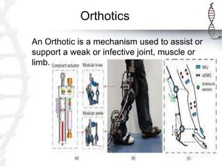 Orthotics
An Orthotic is a mechanism used to assist or
support a weak or infective joint, muscle or
limb.
 