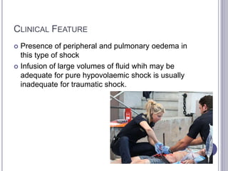 CLINICAL FEATURE
 Presence of peripheral and pulmonary oedema in
this type of shock
 Infusion of large volumes of fluid whih may be
adequate for pure hypovolaemic shock is usually
inadequate for traumatic shock.
 