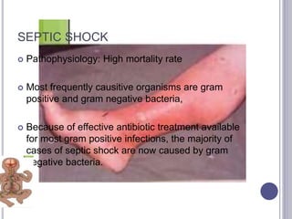SEPTIC SHOCK
 Pathophysiology: High mortality rate
 Most frequently causitive organisms are gram
positive and gram negative bacteria,
 Because of effective antibiotic treatment available
for most gram positive infections, the majority of
cases of septic shock are now caused by gram
negative bacteria.
 