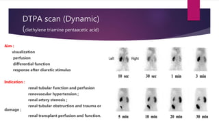 DTPA scan (Dynamic)
(diethylene triamine pentaacetic acid)
Aim :
visualization
perfusion
differential function
response after diuretic stimulus
Indication :
renal tubular function and perfusion
renovascular hypertension ;
renal artery stenosis ;
renal tubular obstruction and trauma or
damage ;
renal transplant perfusion and function.
 