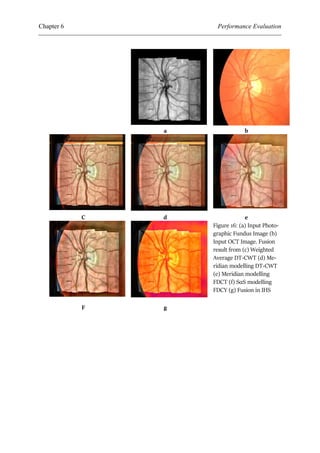 Oct Fusion Application of Medical Image Fusion models, to OCT and Fundus ...