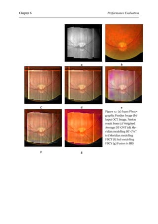 Oct Fusion Application of Medical Image Fusion models, to OCT and Fundus ...