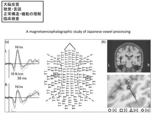 ×Ƥ|
ҙ?Z
?Cܤ
Rʖ
A magnetoencephalographic study of Japanese vowel processing
 