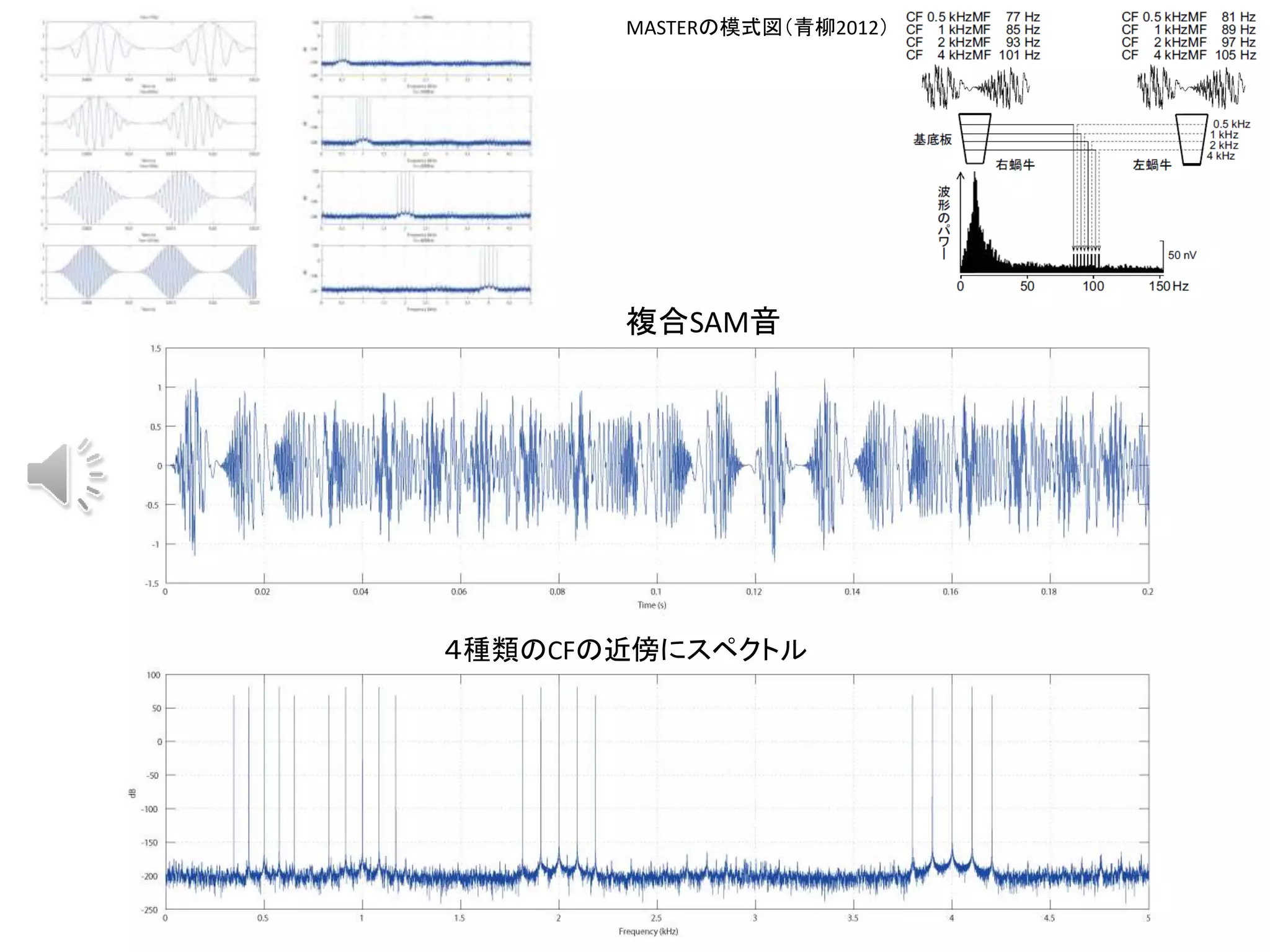 聴力測定技術講習会 ABRとASSR | PPTX | Brain and Nervous System Disorders ...