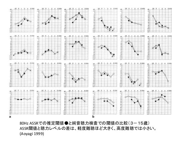 聴力測定技術講習会 Abrとassr