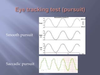 Smooth pursuit
Saccadic pursuit
 
