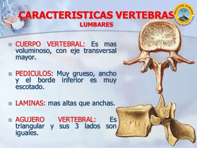 Osteoartrología de la Columna Lumbar