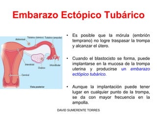 Embarazo Ectópico Tubárico
• Es posible que la mórula (embrión
temprano) no logre traspasar la trompa
y alcanzar el útero....