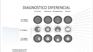 DIAGNOSTICO DIFERENCIAL
Dr. Peterson Xavier da Silva
medpeterson@hotmail.com
 