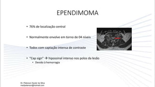 EPENDIMOMA
• 76% de localização central
• Normalmente envolve em torno de 04 níveis
• Todos com captação intensa de contraste
• “Cap sign”  hipossinal intenso nos polos da lesão
• Devido à hemorragia
Dr. Peterson Xavier da Silva
medpeterson@hotmail.com
 