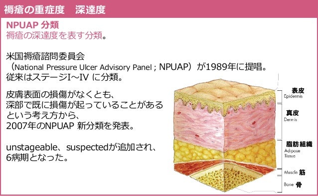褥瘡の評価と実践 Assessment Practice Of Pressure Ulcer
