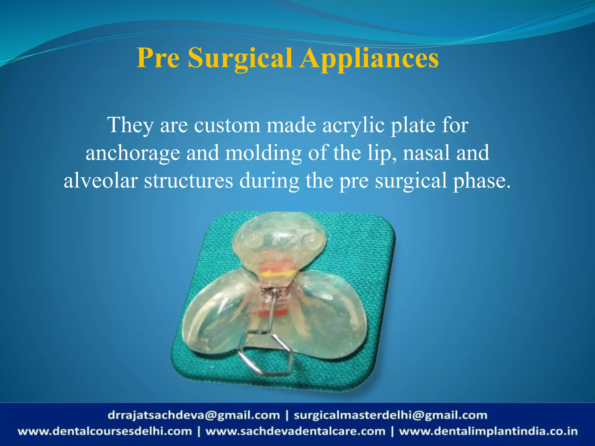 Cleft lip/Cleft Palate | Cleft Lip, Cleft Palate: What is a cleft lip ...