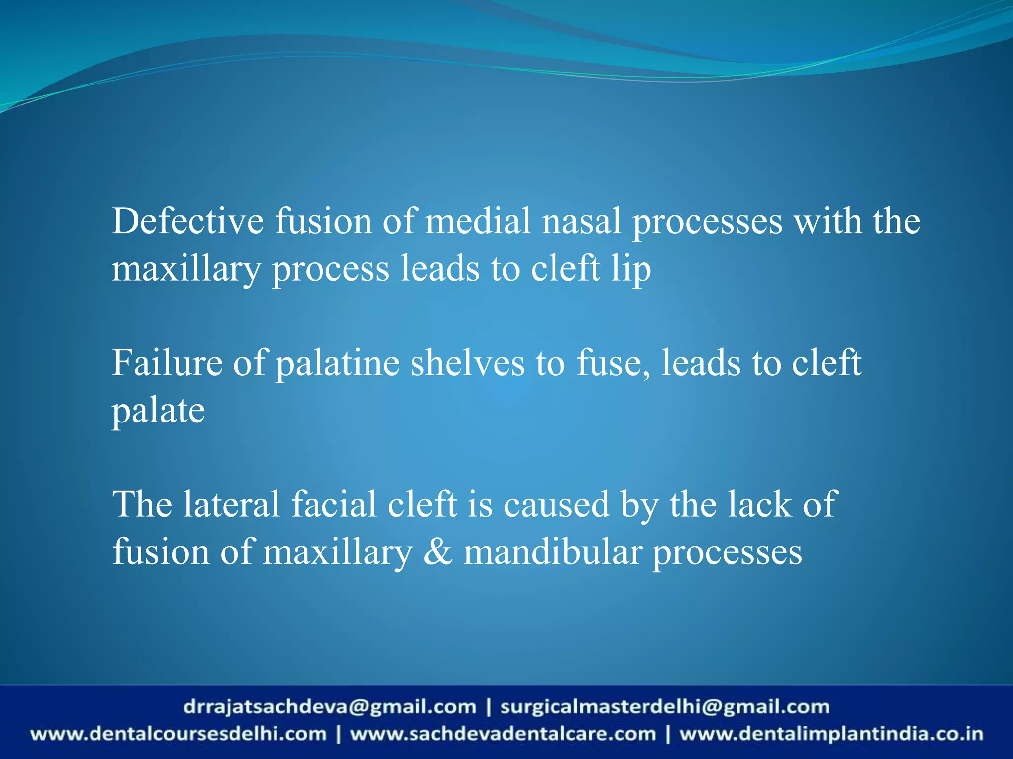 Cleft lip/Cleft Palate | Cleft Lip, Cleft Palate: What is a cleft lip ...