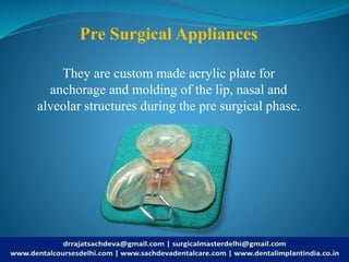Pre Surgical Appliances
They are custom made acrylic plate for
anchorage and molding of the lip, nasal and
alveolar structures during the pre surgical phase.
 