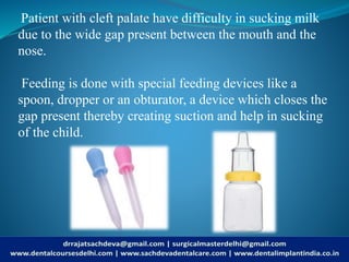 Patient with cleft palate have difficulty in sucking milk
due to the wide gap present between the mouth and the
nose.
Feeding is done with special feeding devices like a
spoon, dropper or an obturator, a device which closes the
gap present thereby creating suction and help in sucking
of the child.
 