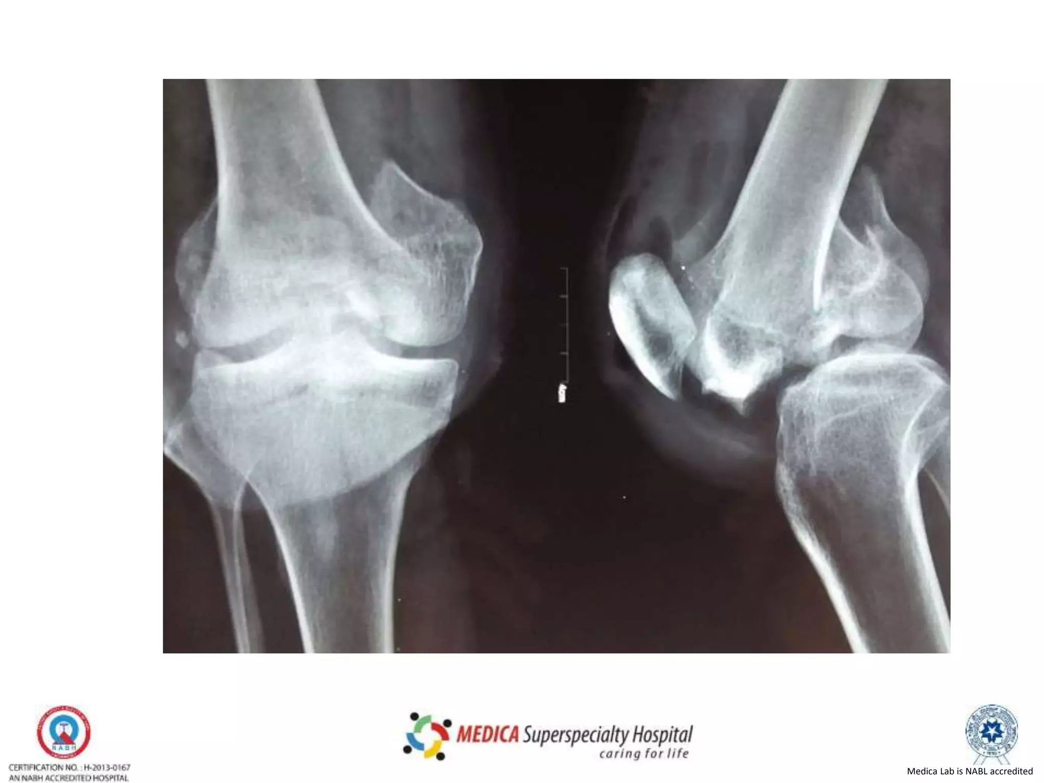 Medica Lab is NABL accredited
 