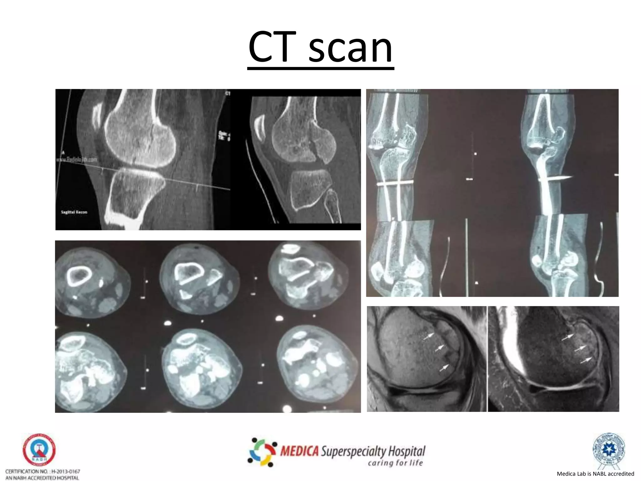 Medica Lab is NABL accredited
CT scan
 