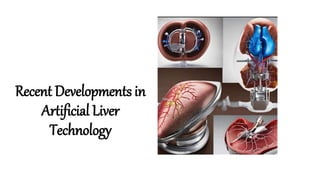 Recent Developments in
Artificial Liver
Technology
 