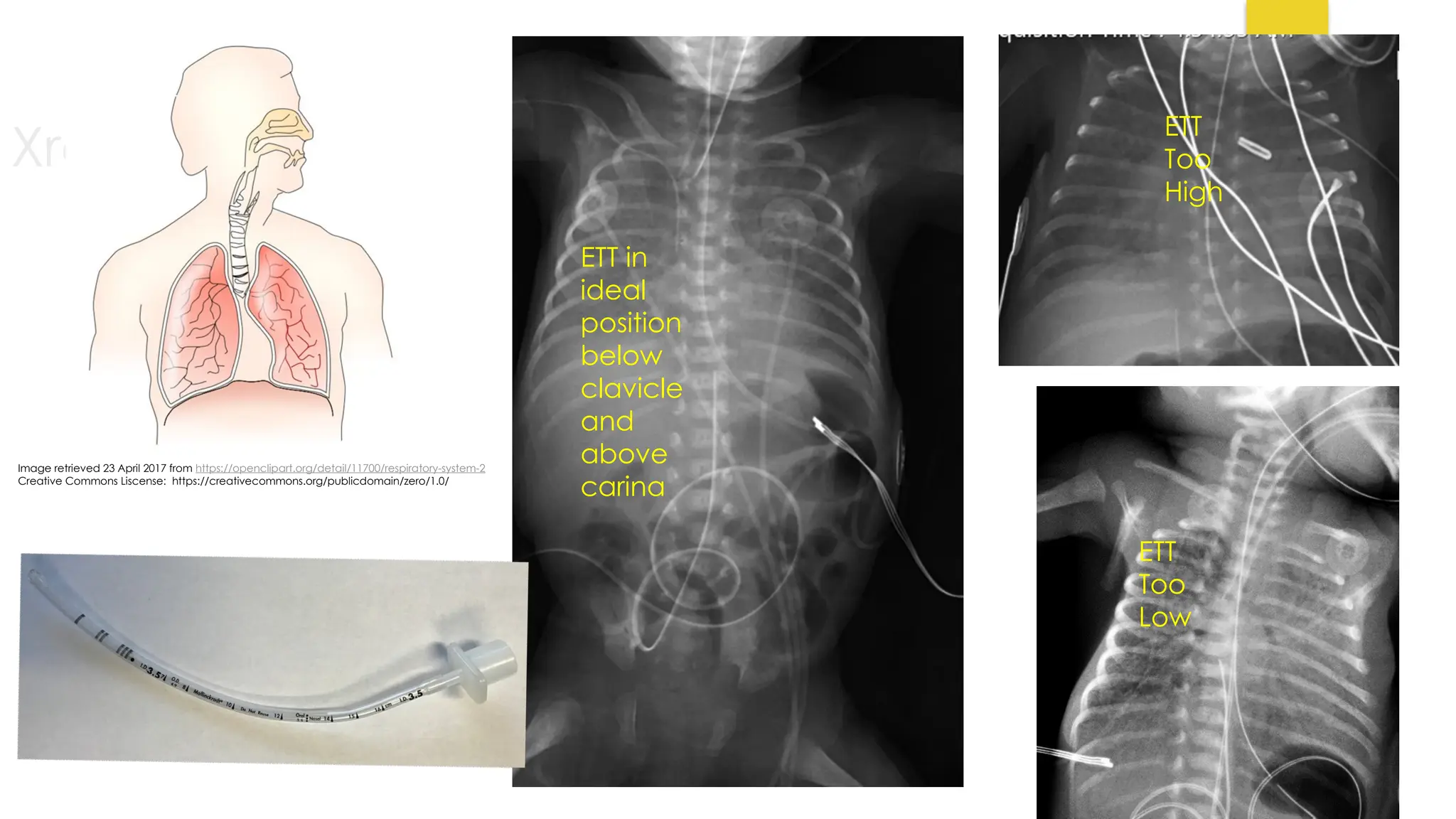 Interpret vital signs and Lab values in the NICU.pptx
