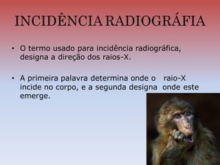 INCIDÊNCIA RADIOGRÁFIA
• O termo usado para incidência radiográfica,
designa a direção dos raios-X.
• A primeira palavra determina onde o raio-X
incide no corpo, e a segunda designa onde este
emerge.
 