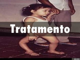 Patologias Virais II