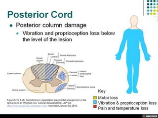 Posterior cord syndrome