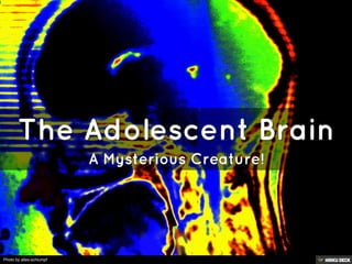 The Adolescent Brain  A Mysterious Creature! 