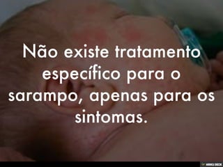 Patologias Virais III