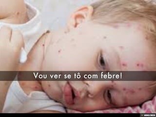 Patologias Virais III