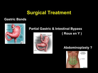 Surgical Treatment
Gastric Bands

                Partial Gastric & Intestinal Bypass
                                      ( Roux en Y )



                                      Abdominoplasty ?
 