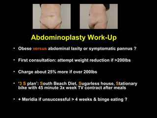 Abdominoplasty Work-Up
• Obese versus abdominal laxity or symptomatic pannus ?

• First consultation: attempt weight reduction if >200lbs

• Charge about 25% more if over 200lbs

• ‘3 S plan’: South Beach Diet, Sugarless house, Stationary
  bike with 45 minute 3x week TV contract after meals

• + Meridia if unsuccessful > 4 weeks & binge eating ?
 