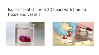 Israeli scientists print 3D heart with human
tissue and vessels
 