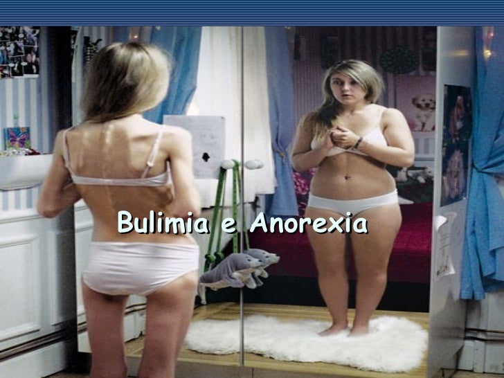 a anorexia e bulimia