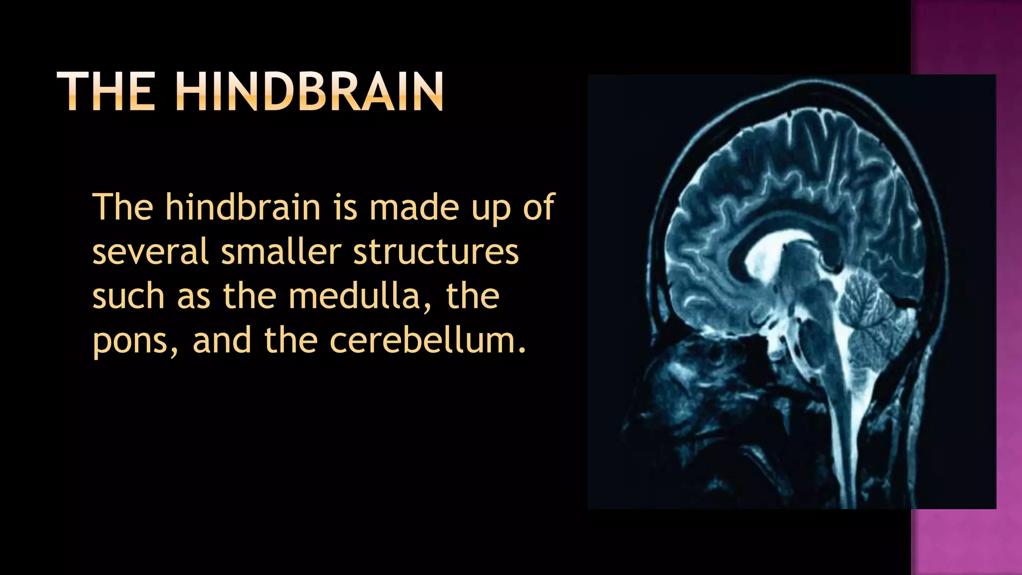 The hindbrain	The hindbrain is made up of several smaller structures such as the medulla, the pons, and the cerebellum.