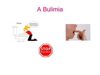 A Bulimia 