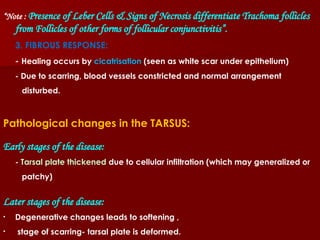 Conjunctiva part A presentation includes anatomy | PPT
