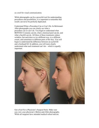 as a tool for visual communication.

While photographs can be a powerful tool for understanding
procedures and possibilities, it is important to remember that
results can never be perfectly duplicated.

Understand What a Procedure Can or Can’t Do. In Beforeand-
After photographs you can clearly see what a
procedure can or can’t do. You begin to understand what
BOTOX® Cosmetic can do, what a chemical peel can do, and
what a facelift can do. All three of these treatments reduce
wrinkles, but each does so in a different way, to a different
extent, and sometimes to different parts of the face. You will
begin to understand the difference between an eyelid lift
and a forehead lift. In addition, you will more clearly
understand what each treatment can’t do – which is equally
important.




Get a Feel For a Physician’s Surgical Style. Make sure
you view your physician’s Before-and-After photographs.
While all surgeons have attended medical school and are
 