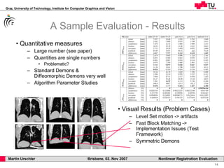 A Sample Evaluation - Results Quantitative measures Large number (see paper) Quantities are single numbers Problematic? Standard Demons &  Diffeomorphic Demons very well Algorithm Parameter Studies Visual Results (Problem Cases) Level Set motion -> artifacts Fast Block Matching -> Implementation Issues (Test Framework) Symmetric Demons 