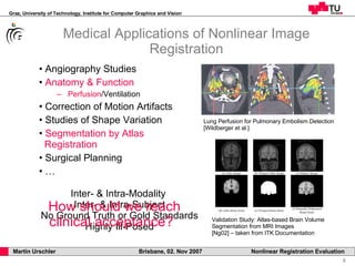 Medical Applications of Nonlinear Image Registration Angiography Studies Anatomy & Function   Perfusion /Ventilation Correction of Motion Artifacts Studies of Shape Variation Segmentation by Atlas    Registration Surgical Planning … Lung Perfusion for Pulmonary Embolism Detection [Wildberger et al.] Validation Study: Atlas-based Brain Volume Segmentation from MRI Images [Ng02] – taken from ITK Documentation Inter- & Intra-Modality  Inter- & Intra-Subject No Ground Truth or Gold Standards Highly Ill-Posed How should we reach clinical acceptance?   
